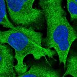 RALGAPA2 Polyclonal Antibody
