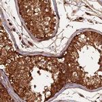 RALGAPA2 Antibody in Immunohistochemistry (IHC)
