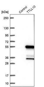 TTLL10 Antibody in Western Blot (WB)