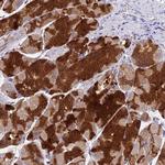 VKORC1 Antibody in Immunohistochemistry (Paraffin) (IHC (P))