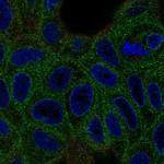VKORC1 Polyclonal Antibody