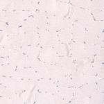 SMC6 Polyclonal Antibody