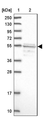 SRFBP1 Antibody in Western Blot (WB)