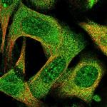 MRI1 Polyclonal Antibody