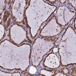 MRI1 Antibody in Immunohistochemistry (Paraffin) (IHC (P))