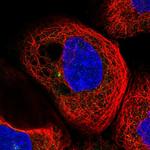 RIC8B Polyclonal Antibody