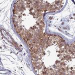 RIC8B Antibody in Immunohistochemistry (IHC)