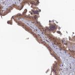 RIC8B Antibody in Immunohistochemistry (IHC)