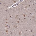 RIC8B Antibody in Immunohistochemistry (IHC)