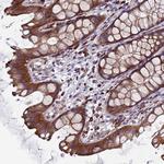 EFCAB8 Polyclonal Antibody