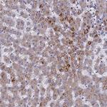 Adenylate Kinase 4 Polyclonal Antibody