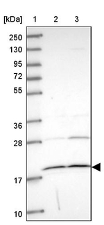 Adenylate Kinase 4 Antibody in Western Blot (WB)