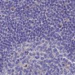 Adenylate Kinase 4 Antibody in Immunohistochemistry (IHC)