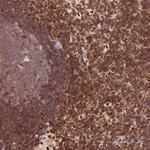 DENND1C Polyclonal Antibody