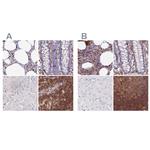 DENND1C Antibody in Immunohistochemistry (IHC)