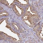 CBWD1 Antibody in Immunohistochemistry (Paraffin) (IHC (P))