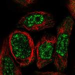 WDR17 Polyclonal Antibody
