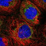 NDUFB9 Polyclonal Antibody