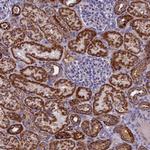 NDUFB9 Antibody in Immunohistochemistry (Paraffin) (IHC (P))