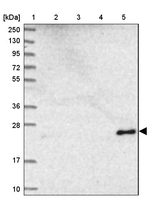 NDUFB9 Antibody in Western Blot (WB)