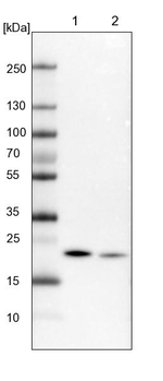 NDUFB9 Antibody in Western Blot (WB)