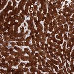 PPP2R2D Polyclonal Antibody
