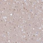 GPR123 Antibody in Immunohistochemistry (Paraffin) (IHC (P))