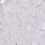 GPR123 Antibody in Immunohistochemistry (Paraffin) (IHC (P))