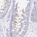 GPR123 Antibody in Immunohistochemistry (Paraffin) (IHC (P))
