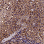PSMB3 Antibody in Immunohistochemistry (Paraffin) (IHC (P))