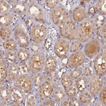 PSMB3 Antibody in Immunohistochemistry (Paraffin) (IHC (P))