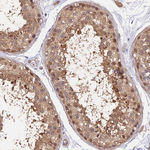 PSMB3 Antibody in Immunohistochemistry (Paraffin) (IHC (P))