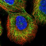 ZNF573 Antibody in Immunocytochemistry (ICC/IF)
