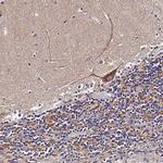 ZNF573 Antibody in Immunohistochemistry (IHC)