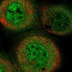 KIAA0100 Polyclonal Antibody