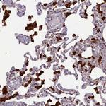 KIAA0100 Antibody in Immunohistochemistry (Paraffin) (IHC (P))