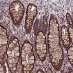 KIAA0100 Antibody in Immunohistochemistry (Paraffin) (IHC (P))