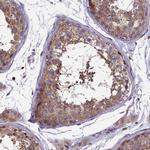 KIAA0100 Antibody in Immunohistochemistry (Paraffin) (IHC (P))