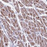 COX3 Antibody in Immunohistochemistry (Paraffin) (IHC (P))