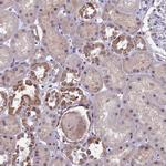 COX3 Antibody in Immunohistochemistry (Paraffin) (IHC (P))