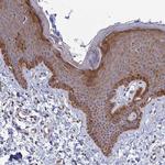 COX3 Polyclonal Antibody