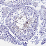 ISCA1 Antibody in Immunohistochemistry (Paraffin) (IHC (P))