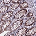 FAM131A Antibody in Immunohistochemistry (Paraffin) (IHC (P))