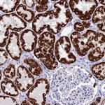 FAM55D Antibody in Immunohistochemistry (Paraffin) (IHC (P))