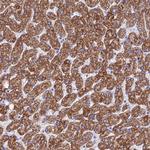 FAM55D Antibody in Immunohistochemistry (Paraffin) (IHC (P))