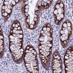 FAM55D Antibody in Immunohistochemistry (Paraffin) (IHC (P))