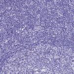 FAM55D Antibody in Immunohistochemistry (Paraffin) (IHC (P))