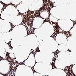 YPEL5 Antibody in Immunohistochemistry (IHC)