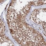 KIAA1257 Polyclonal Antibody