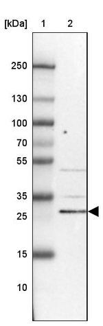 KIAA1257 Antibody in Western Blot (WB)